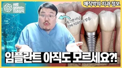 치과의사가 알려주는 임플란트의 모든것
