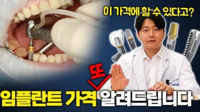 오스템 임플란트 가격 과 임플란트 비용 차이가 나는 이유